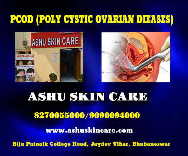 best PCOD treatment clinic in bhubaneswar near me - ashu skin care